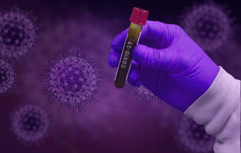 Coronavirus : avec 5 nouveaux cas le Tchad compte désormais 23 cas déclarés