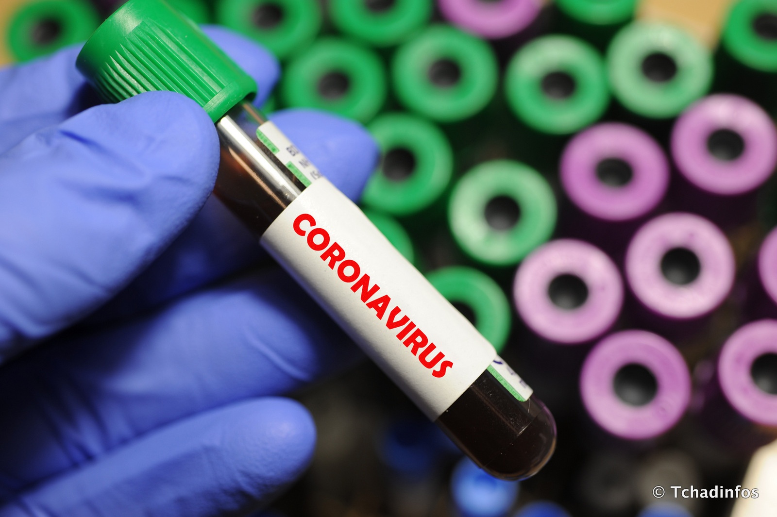 Coronavirus : 25 nouveaux cas dont 17 à N’Djamena