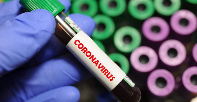 Coronavirus : 44 cas confirmés ce 03 janvier