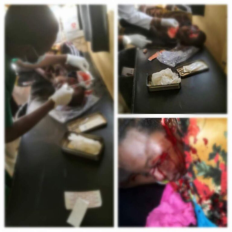 Tchad/Faits divers : les victimes de l’agression de la panthère sont toujours à l’hôpital
