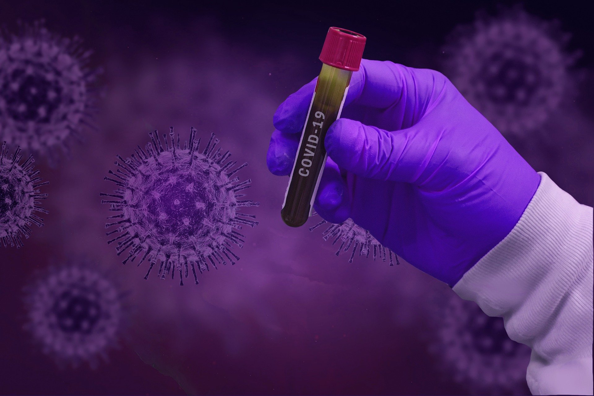 Coronavirus : avec 5 nouveaux cas le Tchad compte désormais 23 cas déclarés