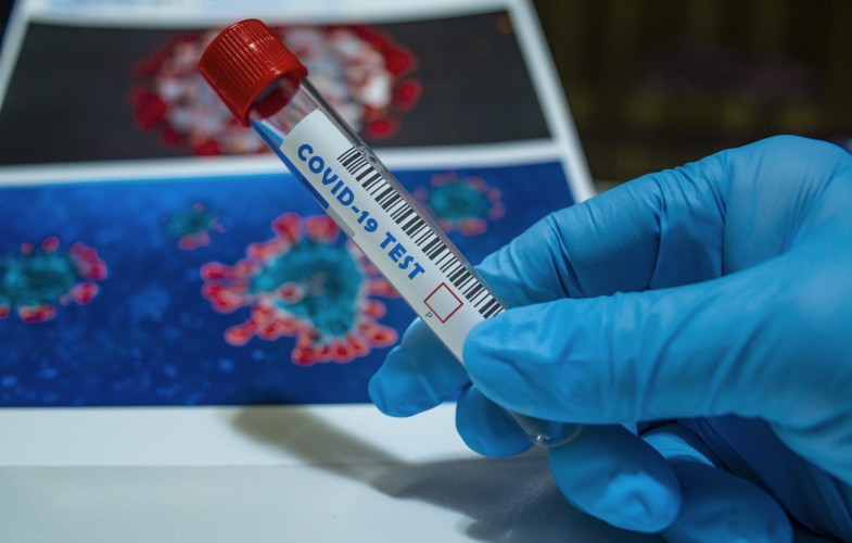 Coronavirus : 04 nouveaux cas à N’Djaména, 00 guéri et 00 décès