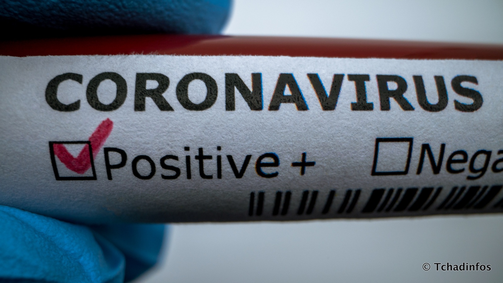 Coronavirus : le Tchad dépasse la barre de 500 cas confirmés