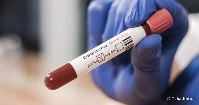 Coronavirus : 9 nouveaux cas détectés au Tchad