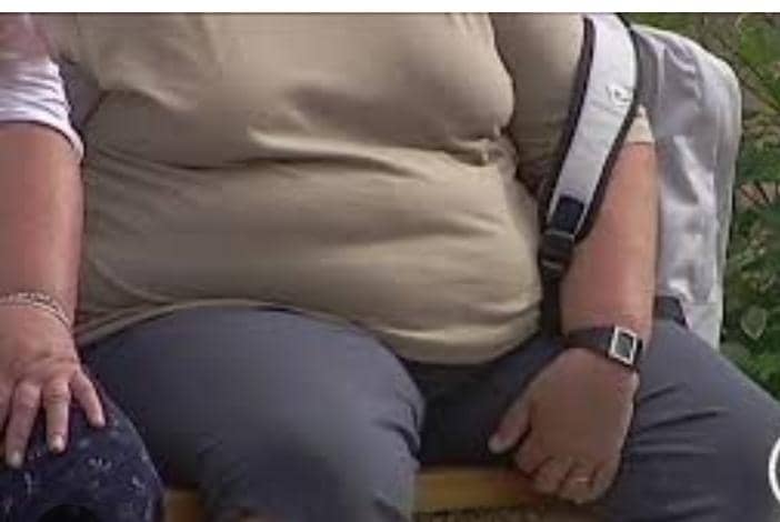 Santé : “l’obésité est une maladie qui peut sugir à tout moment de la vie”, Dr Ibrahim Foba