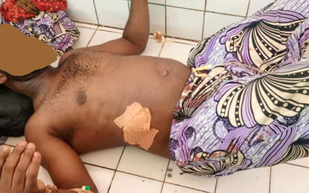 Insécurité : Le propriétaire d’un bar à Kabalaye, victime de tirs à bout portant